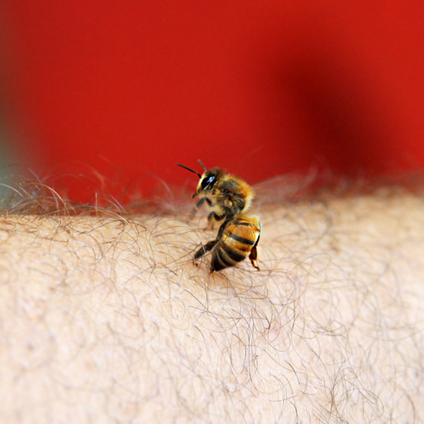 abeille qui pique un bras