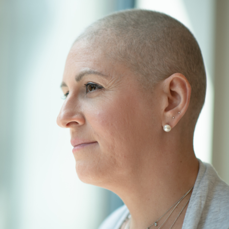 Une femme montre se retrouve sans cheveux en raison de son traitement anticancéreux