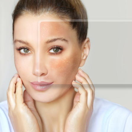 Une femme présente les signes d'une peau sèche sur le visage