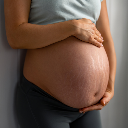 Une femme enceinte tient son ventre et présente des vergetures